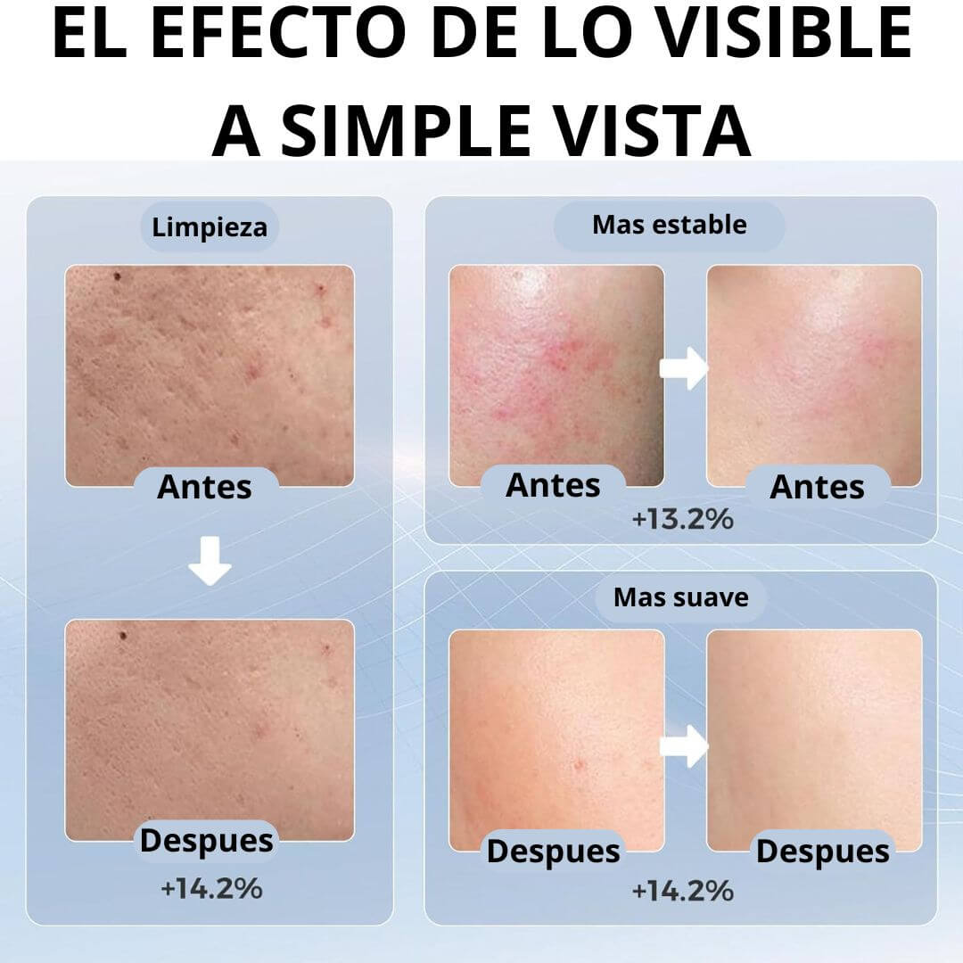 Máscara facial LED