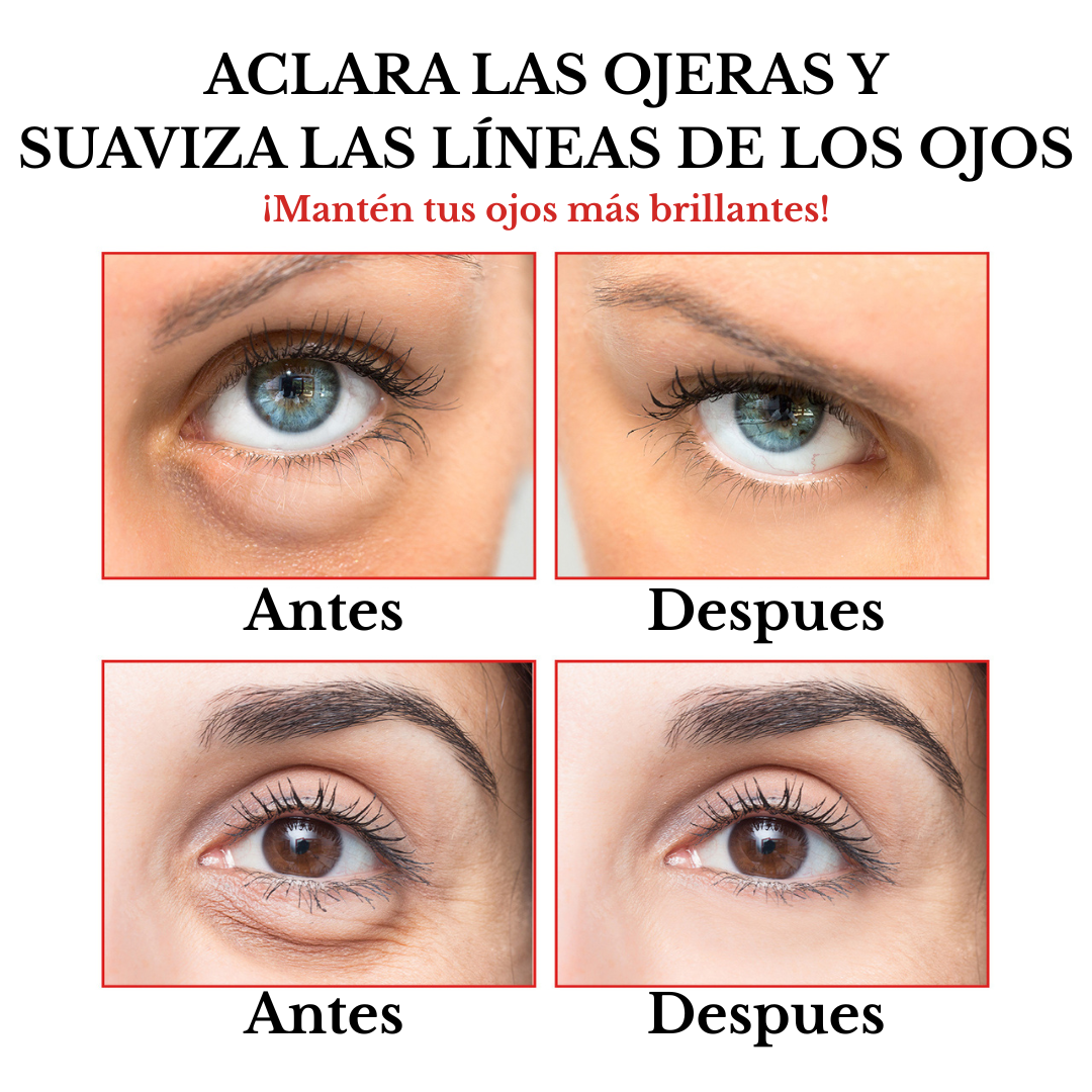 Serum removedor de contorno - OUHOE
