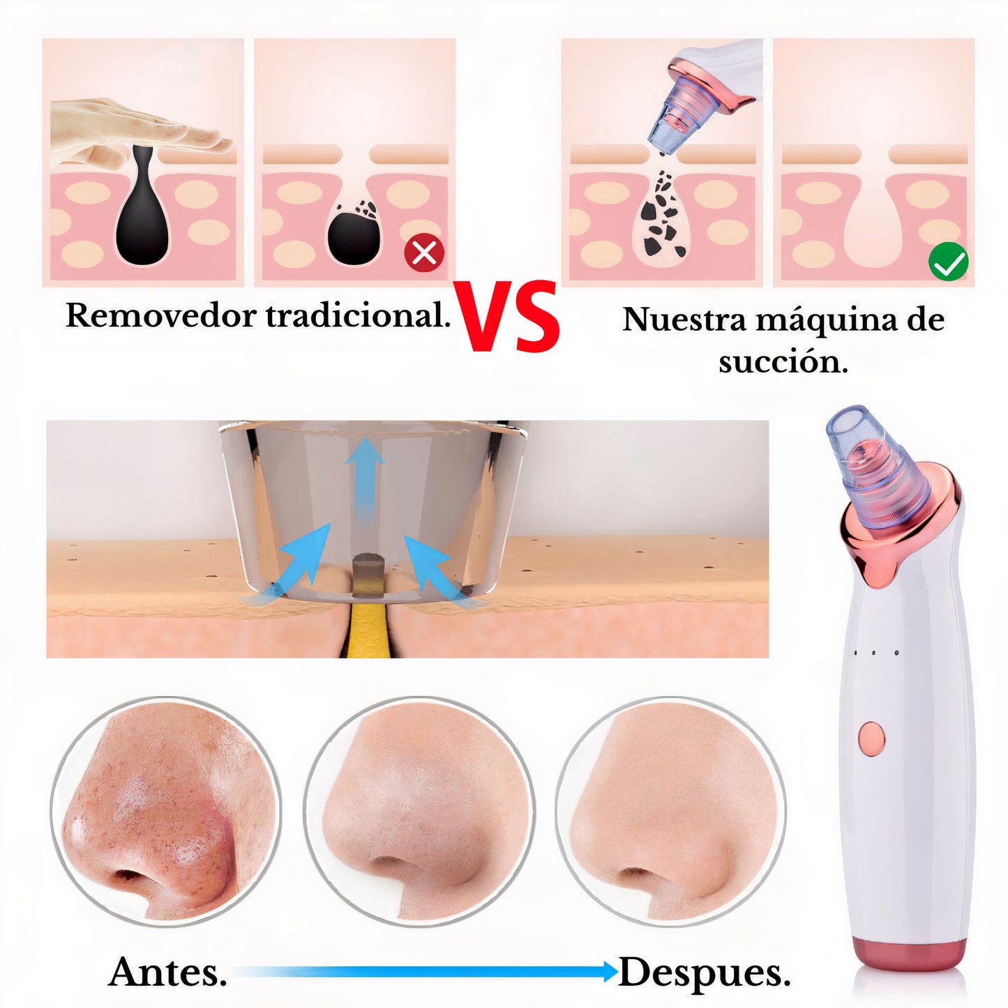 Extractor de Puntos Negros