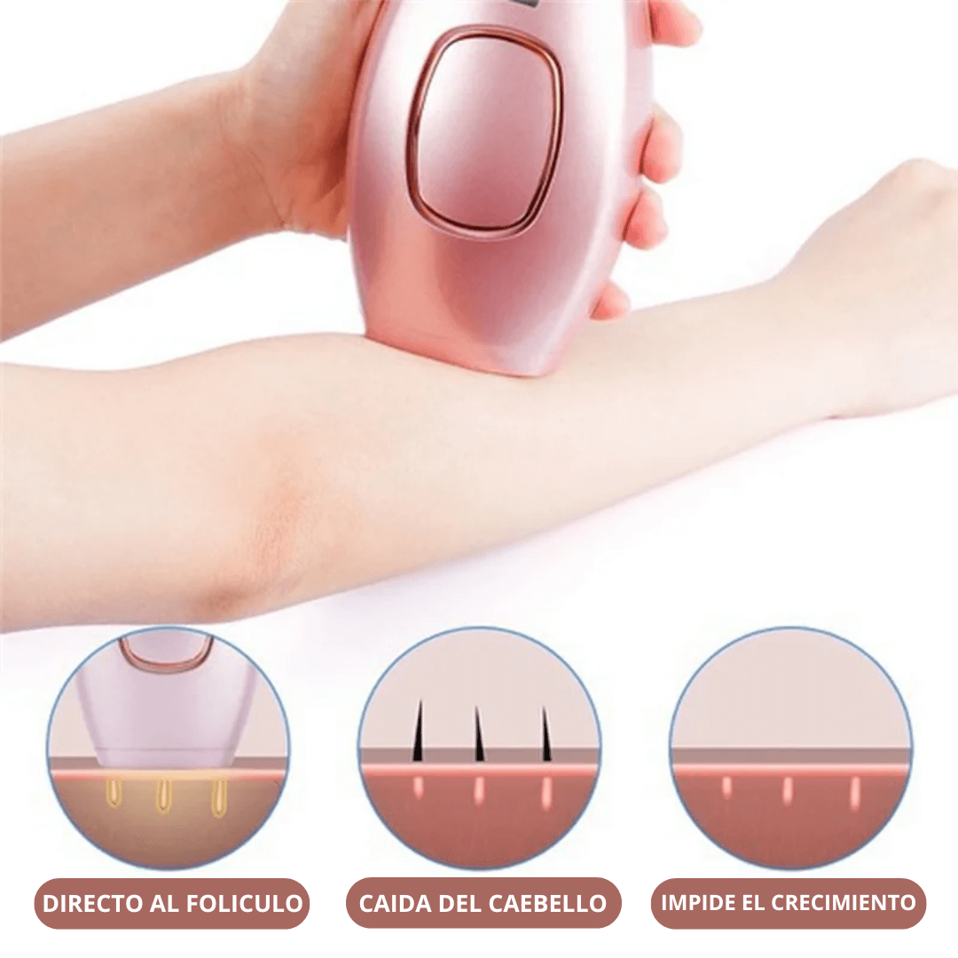 Depiladora laser IPL.